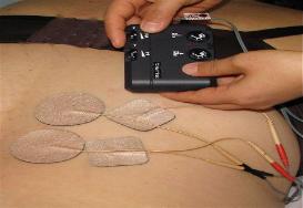 A TENS unit is a small, portable, battery-powered device. 